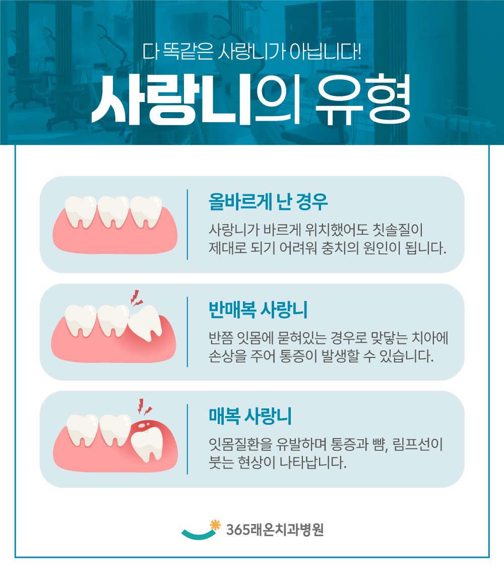 평택사랑니발치 안내 4